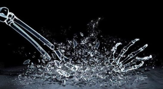 Cam kemik hastalığı nedir?